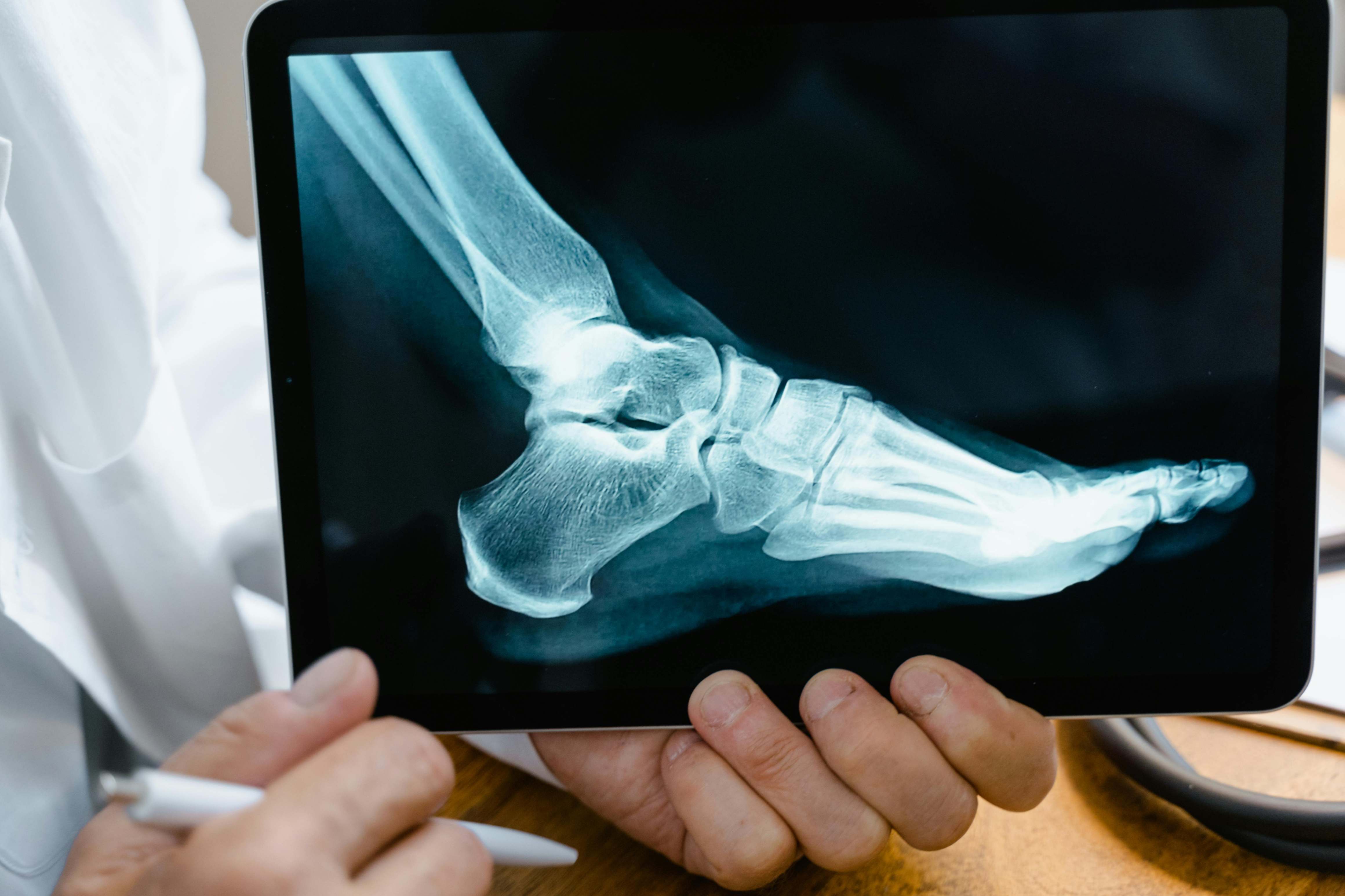 Catastrophic Injury Lawyer